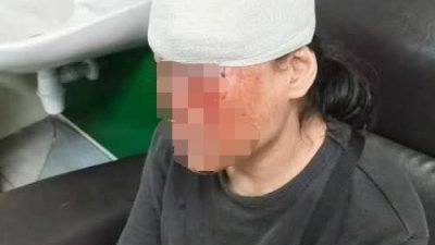 【肉骨茶店围殴案】冀严惩3嫌犯 受害者:害怕遭报复