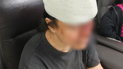 【肉骨茶店围殴案】受害者还原事发原由 因声量大瞥一眼就遭殃